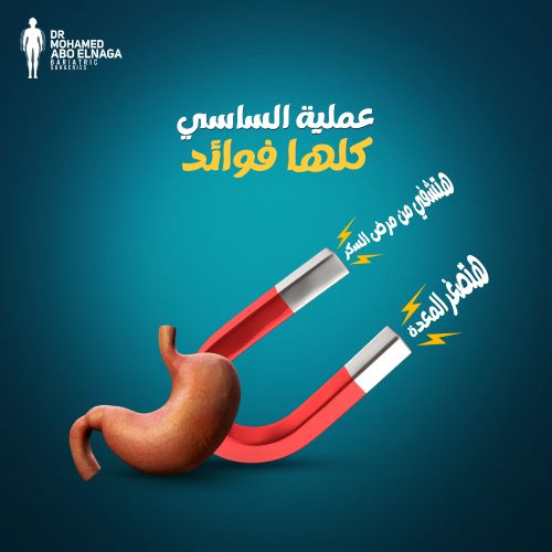 معدل نزول الوزن بعد عملية الساسي